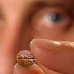 "Nanobeyin" nədir və ya o nə üçündür? - 4 "Nanobeyin" nədir və ya o nə üçündür? - 4